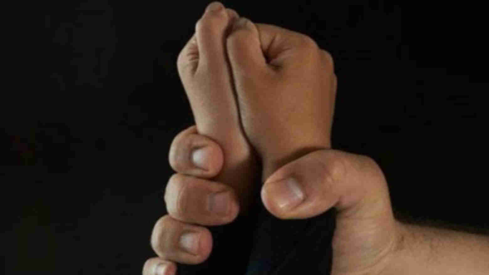 Dokter di NTT Nyaris Diperkosa dan Dibunuh