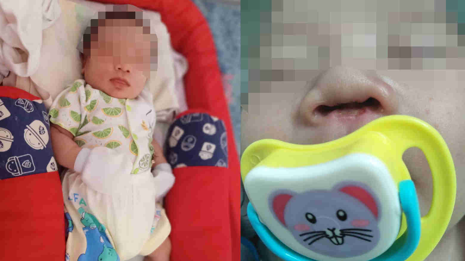 Dugaan Malpraktek Bayi, Ini Tanggapan Jubir RS Konawe