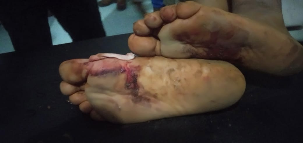 Gegara Ore Nikel, Karyawan PT Timah Diparangi