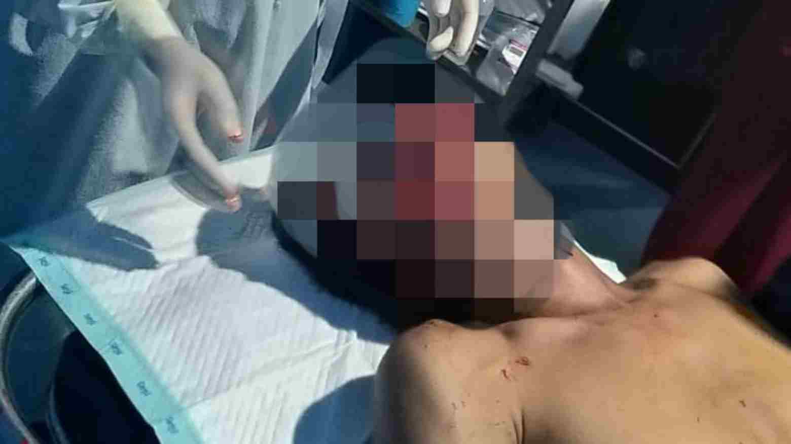 Tabrak Trotoar, Pengendara Motor di Kolut Meninggal di Perjalanan Menuju RS