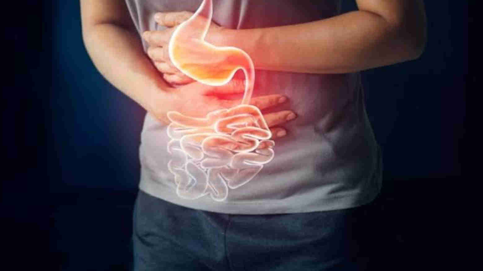 Benarkah Biji Cabai Dapat Menyebabkan Usus Buntu? Ini Penjelasannya