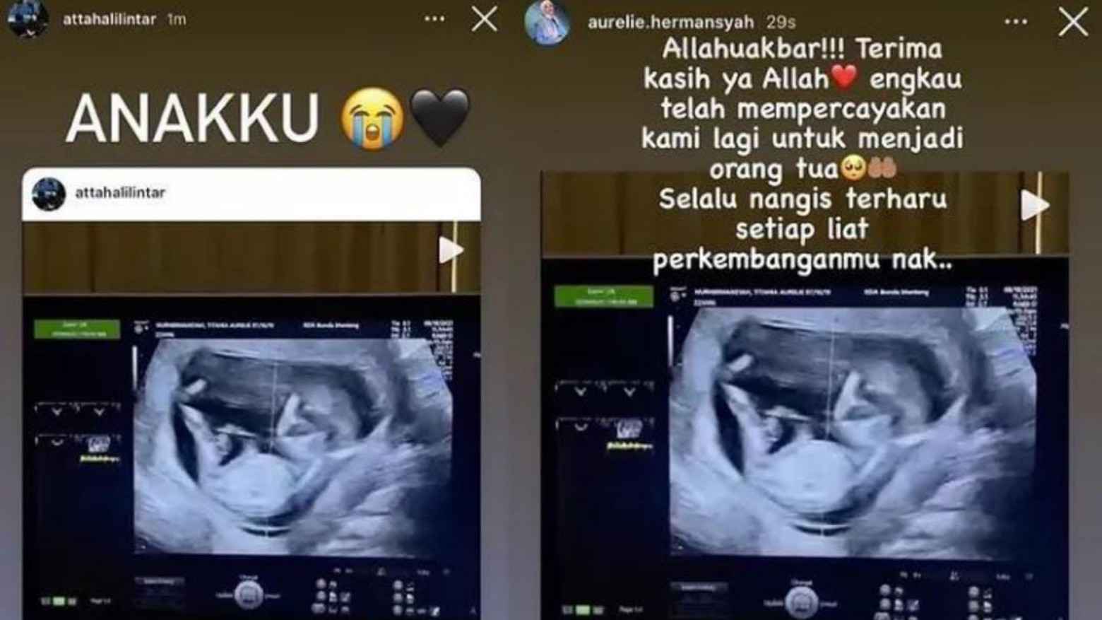 Atta Halilintar Umumkan Kehamilan Kedua Aurel Pasca Tiga Bulan Dirahasiakan
