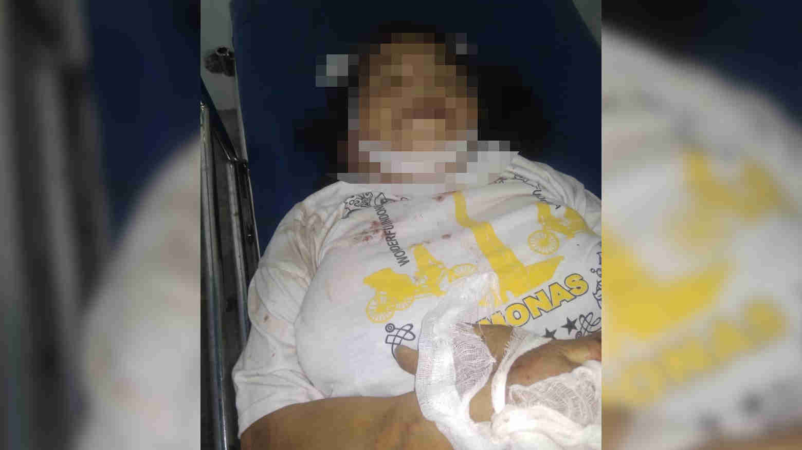 Seorang Ibu di Kendari Meninggal Dunia Usai Jadi Korban Tabrak Lari