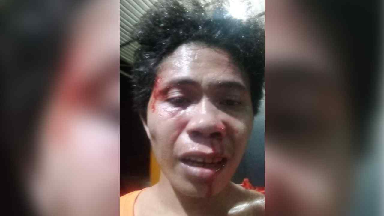 Seorang Mahasiswa Dikeroyok 6 OTK di Taman Perumahan Dosen UHO