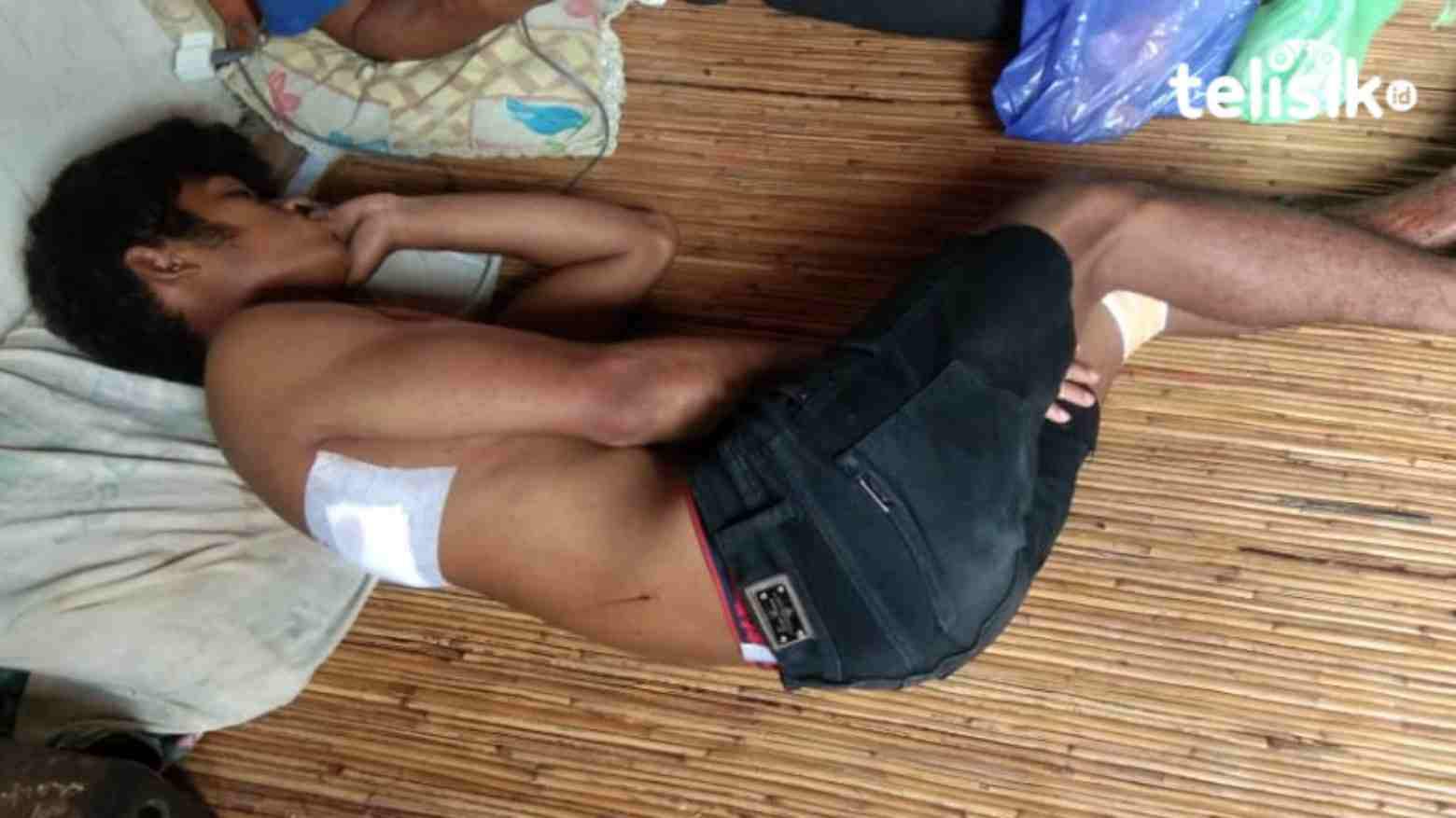 Seorang Pemuda di Pasar Panjang Ditebas Parang OTK Saat Tidur