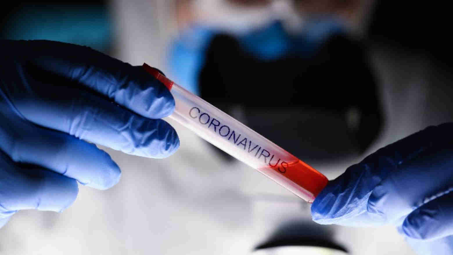 Usai Delta, Masyarakat Kendari Diminta Waspada COVID-19 Varian Mu