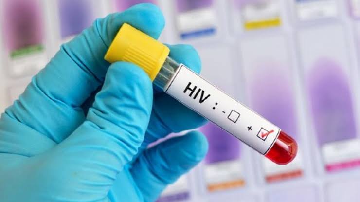 97 Orang di Kendari Positif HIV hingga Oktober 2021