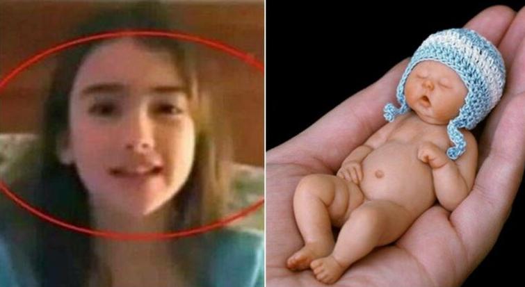 Ingat Bayi Terkecil di Dunia yang Muat di Cangkang Telur? Kini Tumbuh Cantik dan Normal