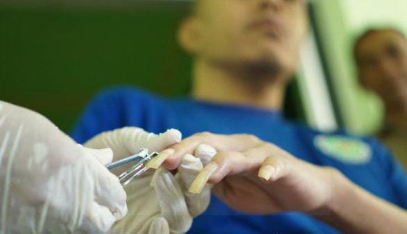 Ini Penyebab Pasien Gangguan Jiwa Sudah Sembuh, Kambuh Lagi