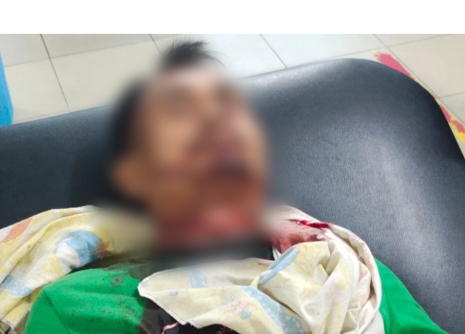 Tega, Anak 4 Tahun Dibunuh Ayah Sendiri dengan Kondisi Begini