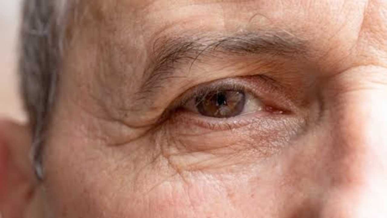 Ingin Hilangkan Kerutan di Wajah secara Alami? Yuk Lakukan 6 Cara ini