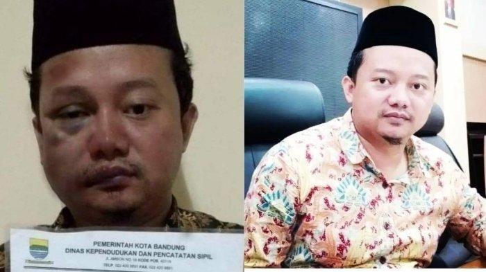Satu Sel dengan Tahanan Begal, Foto Wajah Bonyok Pemerkosa 21 Santri Viral