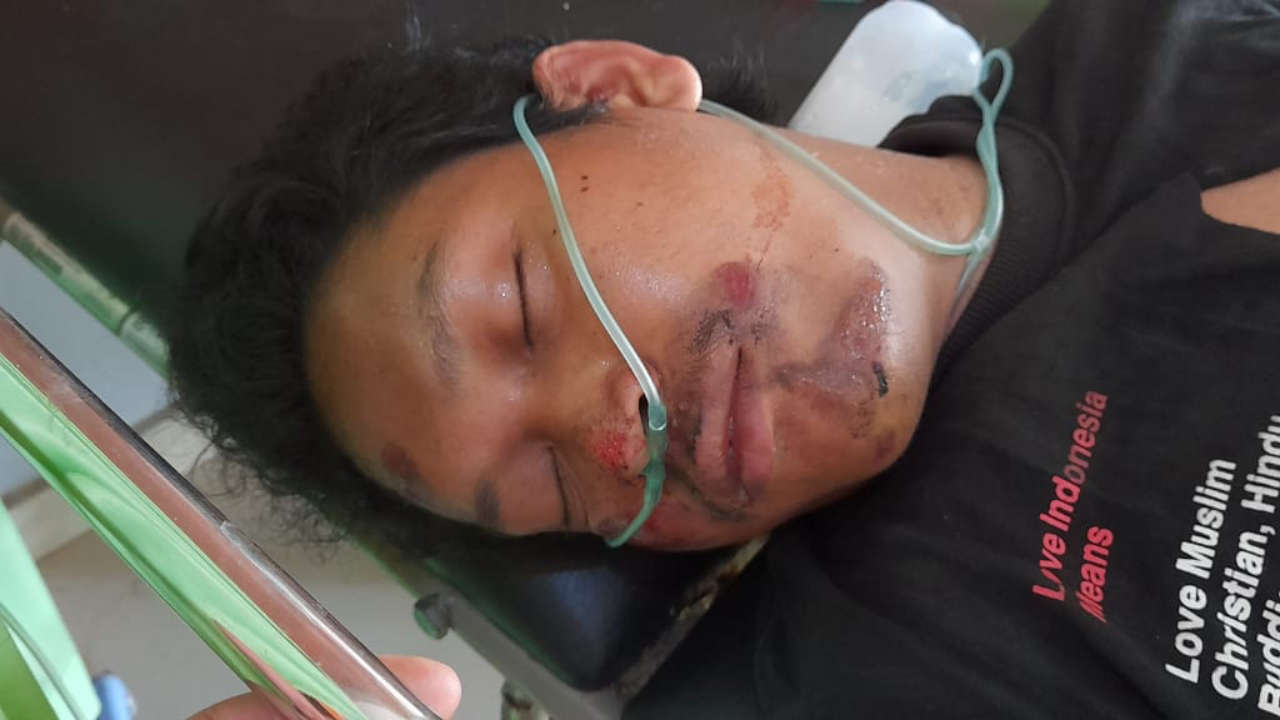 Diduga Mabuk, Pengendara Sepeda Motor Alami Kecelakaan Tunggal