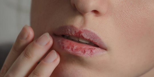 Ini 5 Tips Memilih Lipstik Bagi Kamu yang Punya Bibir Kering dan Pecah-Pecah