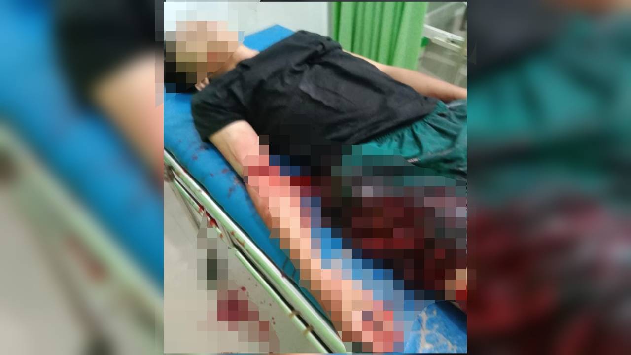 Berawal Cekcok, Gadis 17 Tahun Nekat Tikam Dua Pengunjung Kafe