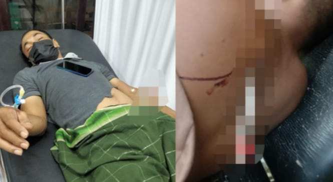 Dua Warga NTT Alami Luka Serius Usai Dipanah OTK