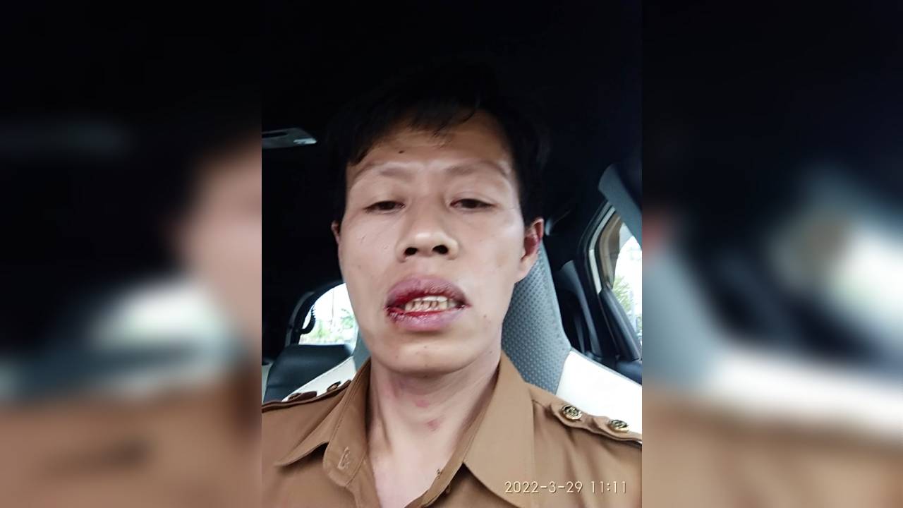 ASN Korban Penganiayaan Mengaku Dipukul Bertubi-tubi Ketua Koperasi di Kendari