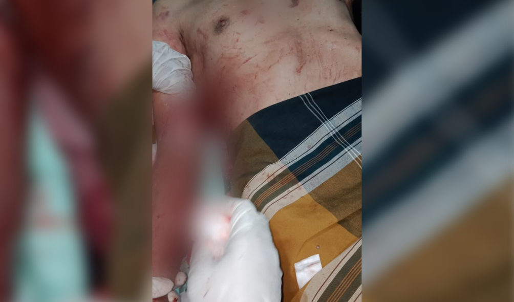 Mandi di Kali, Tangan Warga Muna Barat Nyaris Putus Diterkam Buaya