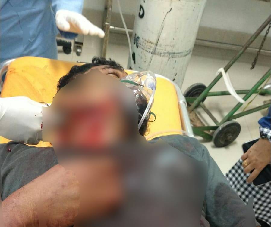 Selepas Acara Organ Tunggal, Warga Mubar Disayat Saat Tidur