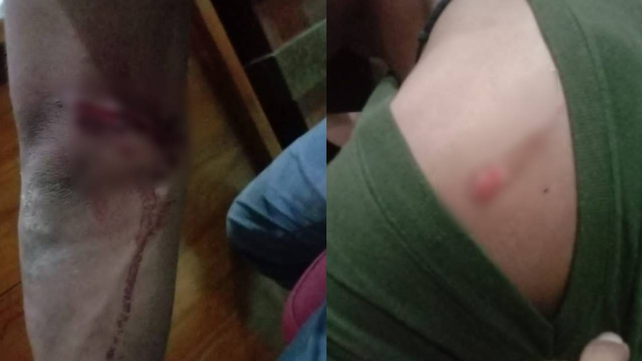 Dilarang Ribut, Sekelompok Orang Pesta Miras Tikam Rekannya