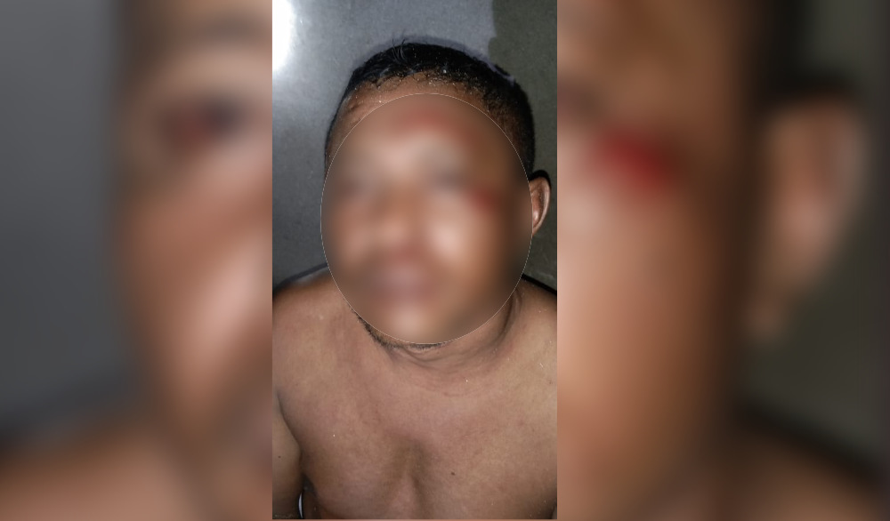 Seorang Pria di Buton Utara Babak Belur Dihajar, Pisau Ditodong di Leher