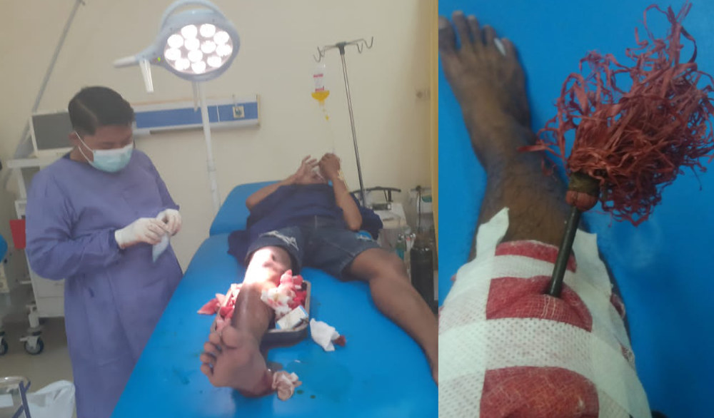 Seorang Pria Jadi Korban Busur di Depan UHO Kendari