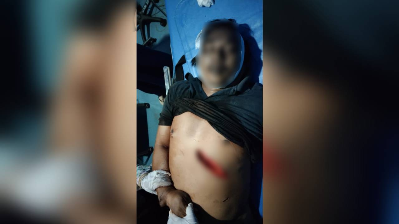 Tak Terima Dibentak, Pemuda Ini Tikam Calo Tiket Kapal Feri hingga Tewas