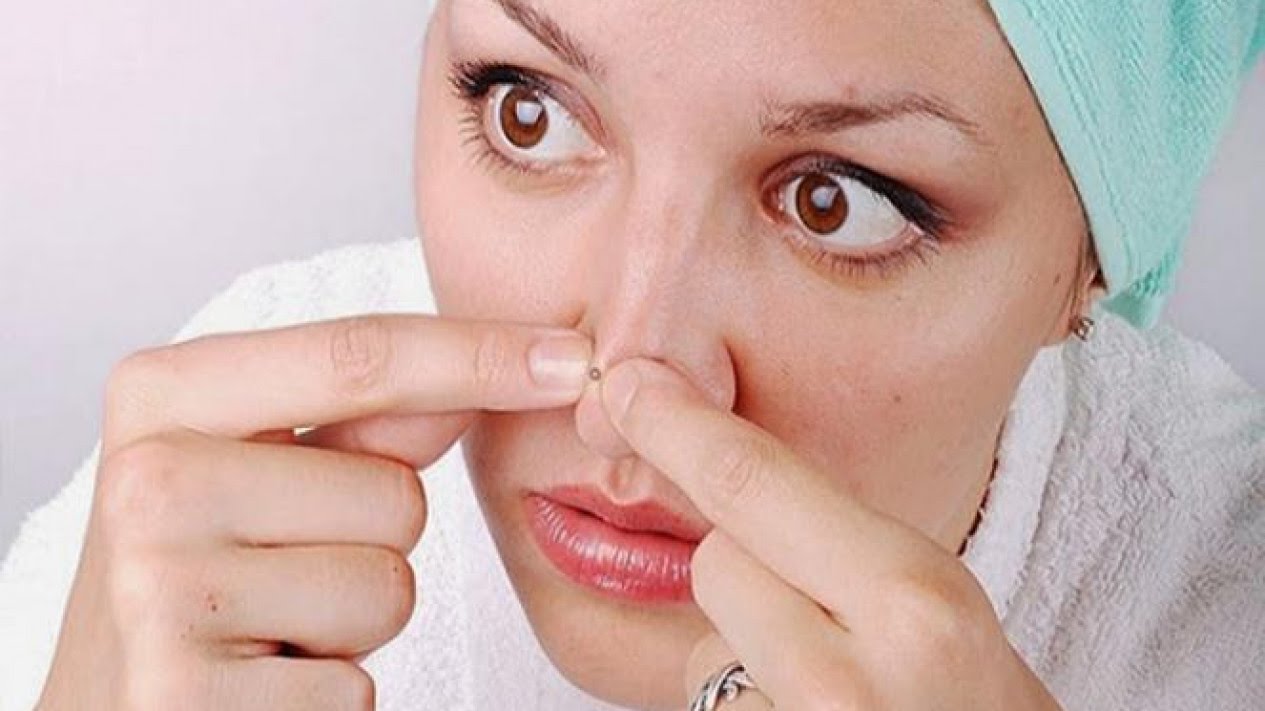 5 Cara Alami Hilangkan Komedo di Hidung