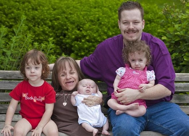 7 Kasus Kehamilan Aneh dan Unik di Dunia, Nomor 4 dari Indonesia