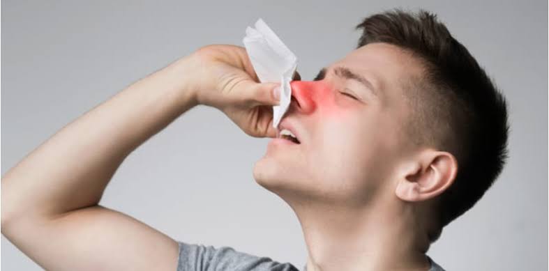 Catat, 5 Jenis Obat Ini Bisa Atasi Hidung Tersumbat