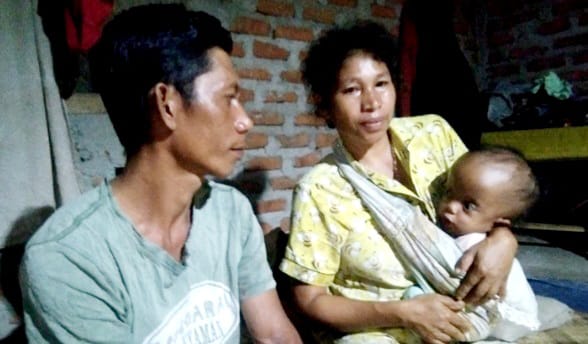 Kisah Pilu Anak Penderita Hidrosefalus di Manggarai Barat yang Butuh Uluran Tangan