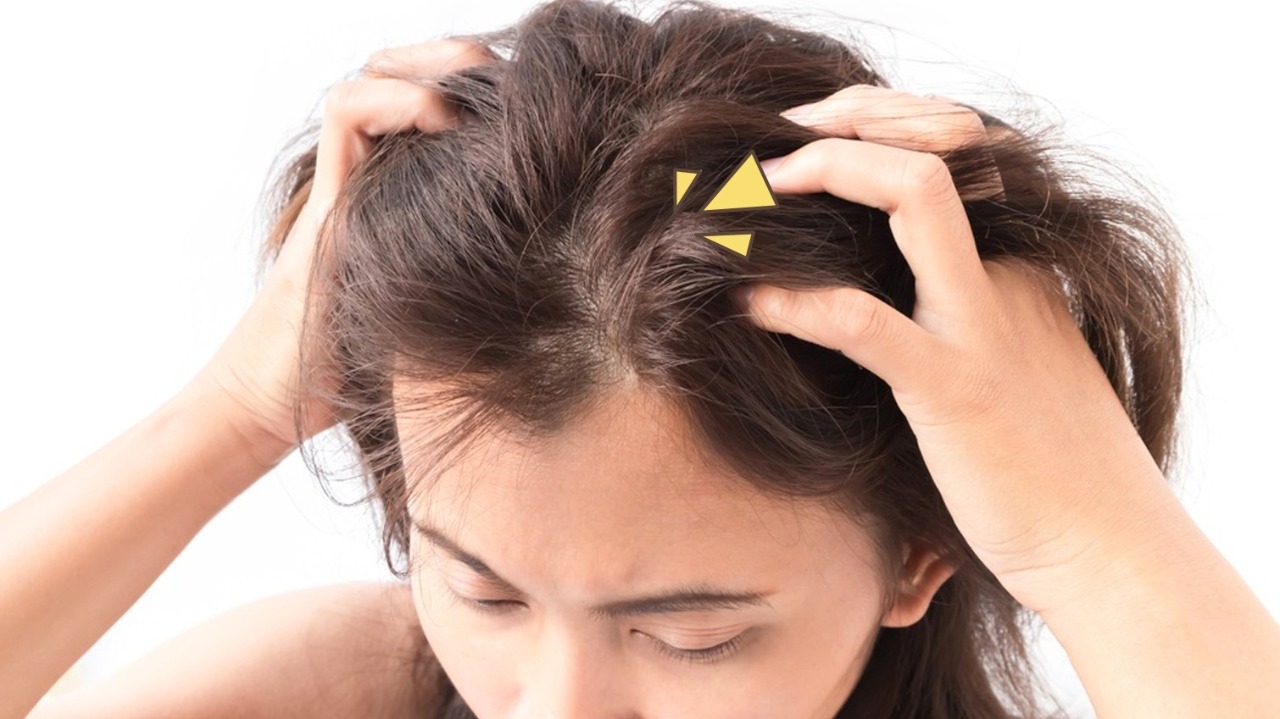 6 Cara Atasi Rambut Berminyak Dijamin Tidak Lepek
