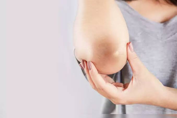 Kenapa Lutut dan Siku Berwarna Gelap? Ini Penjelasannya