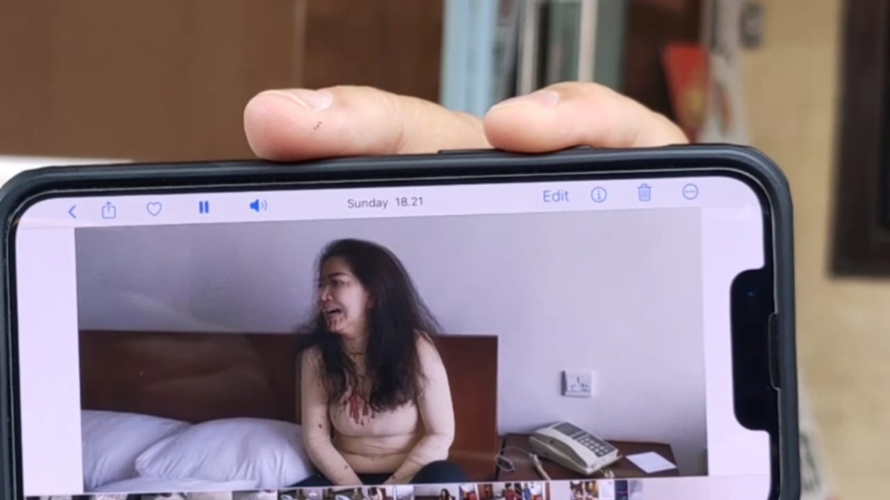 Polisi Periksa 5 Saksi KDRT yang Dialami Venna Melinda