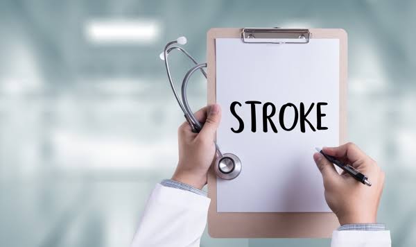 Waspada, 7 Gejala Stroke Ini Dialami Usia Muda
