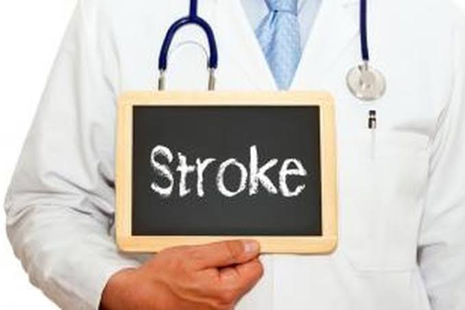 4 Kebiasaan Sederhana Ini Bisa Cegah Kamu Terserang Stroke