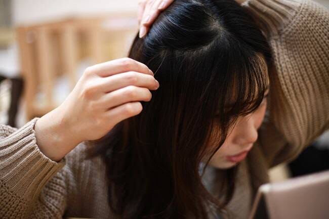 Benarkah Stres Menyebabkan Rambut Beruban?