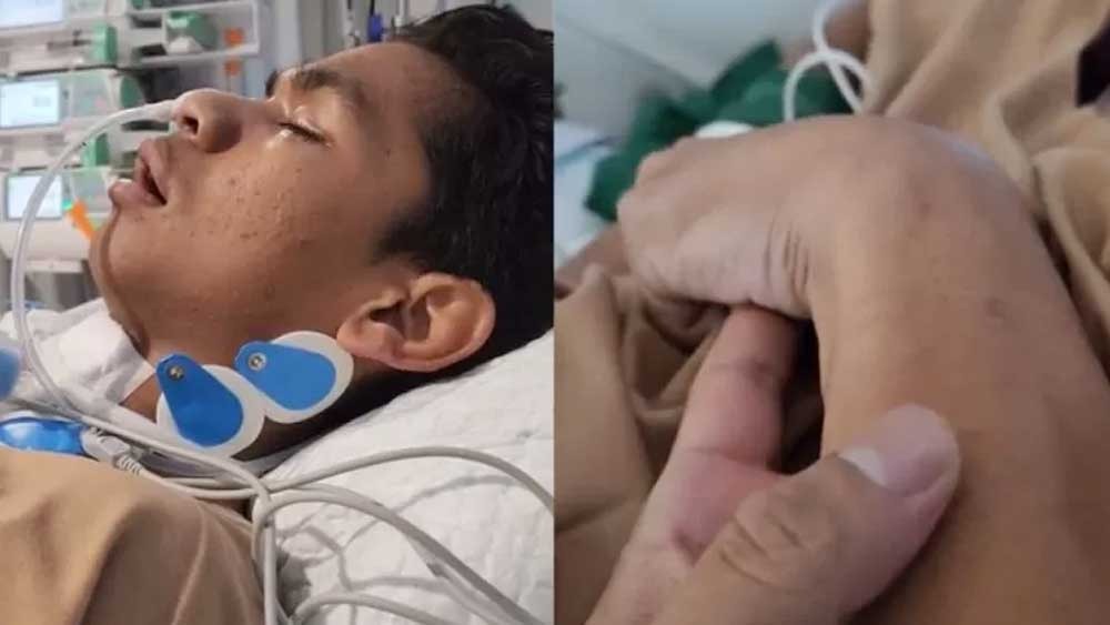 David Korban Penganiyaan Mario Dandy Berjuang Sembuh, Terapi Musik Heavy Metal