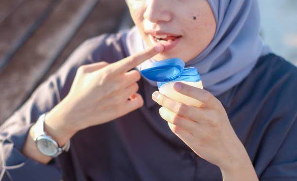 5 Tips Mudah Atasi Bibir Kering Saat Puasa