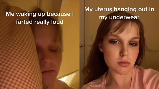 Viral: Rahim Gadis 17 Tahun Rontok karena Kentut Sangat Keras