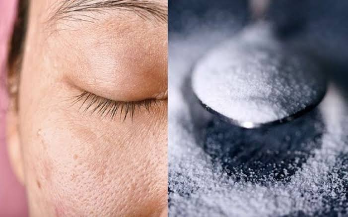 Hilangkan Flek Hitam dengan Gula Pasir, Begini Caranya