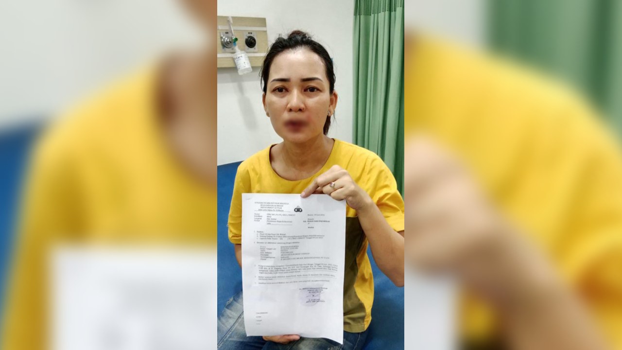 Ibu Rumah Tangga Bonyok Dikeroyok Pasutri, Polisi: Kami Tindaklanjuti