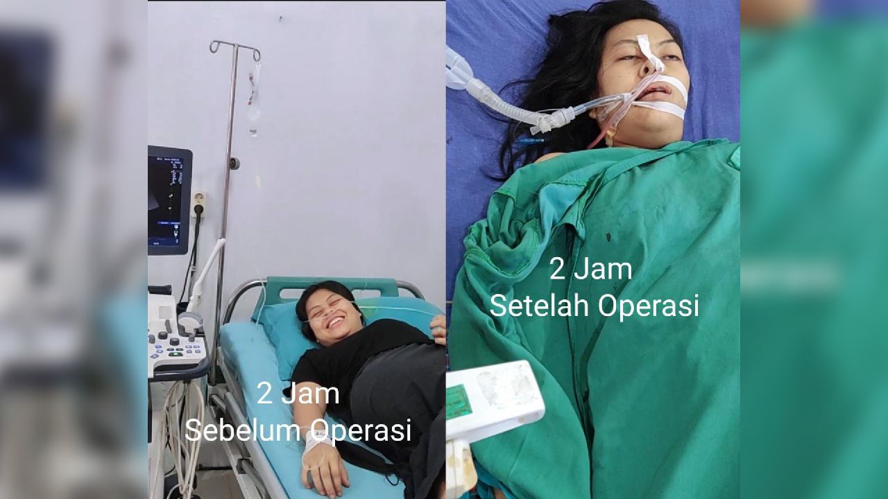 Wanita Ini Tewas Usai Operasi di RS Amri Tambunan, Suami Minta Dokter jadi Tersangka