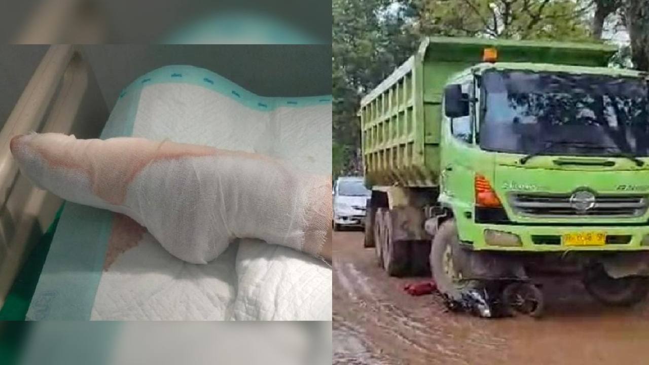 Keluarga Korban Kecelakaan Mobil Truk di Konawe Tuntut PT Wika Tanggungjawab Seumur Hidup