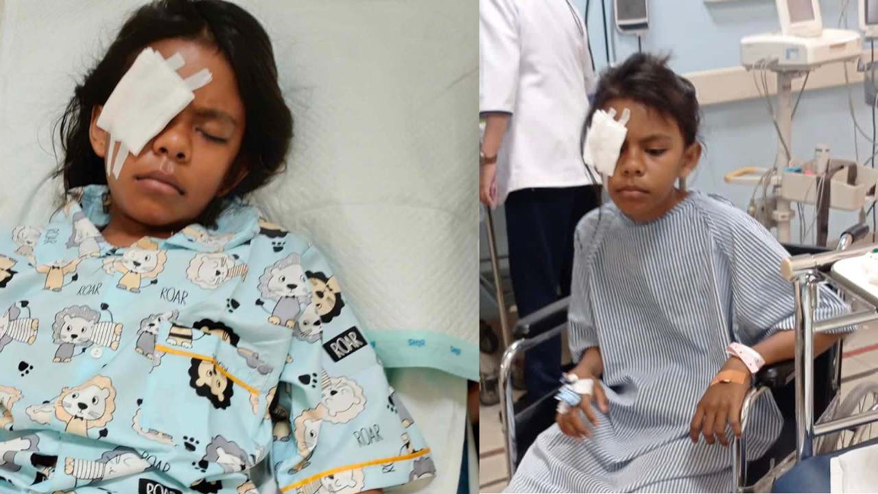 Pelajar SD di Buton Selatan Tusuk Mata Teman Pakai Pipa Paralon