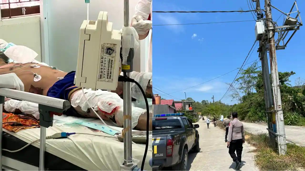 Tersengat Listrik, Karyawan PT Dian Purnama Kendari Meregang Nyawa Usai dapat Perawatan Medis