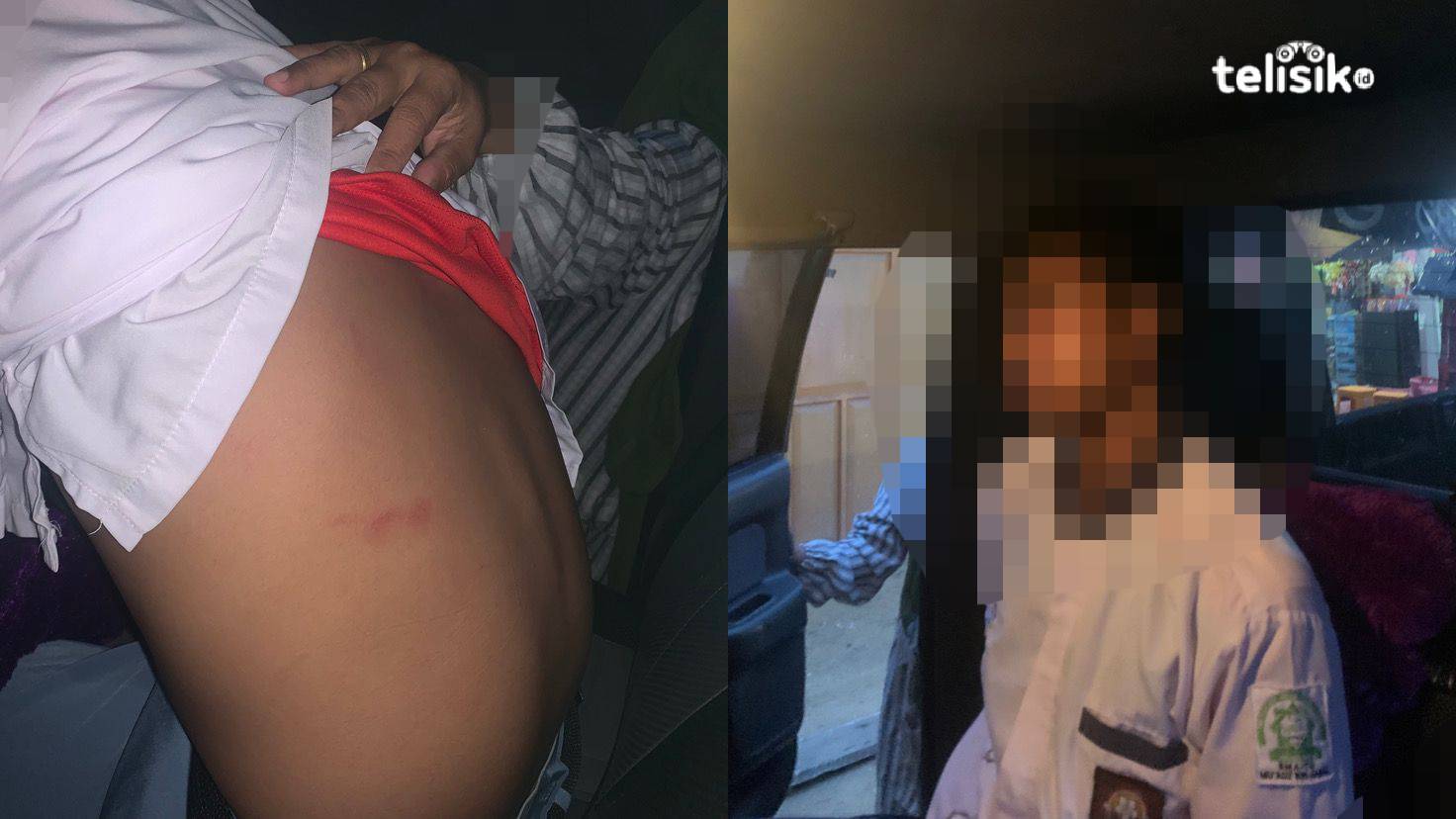 Jadi Korban Bullying, Siswa SMA di Kendari Alami Trauma dan Luka-luka