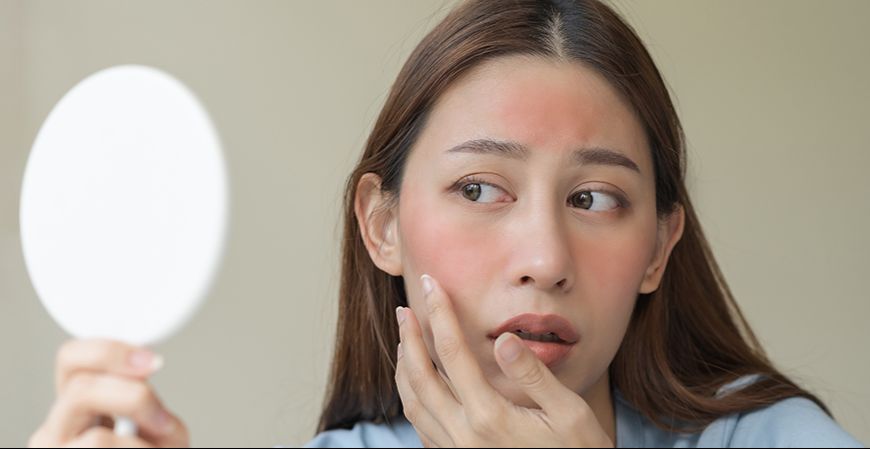 Kulit Wajah Kering, Wajib Lakukan Ini