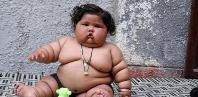 Pencegahan Obesitas Pada Balita