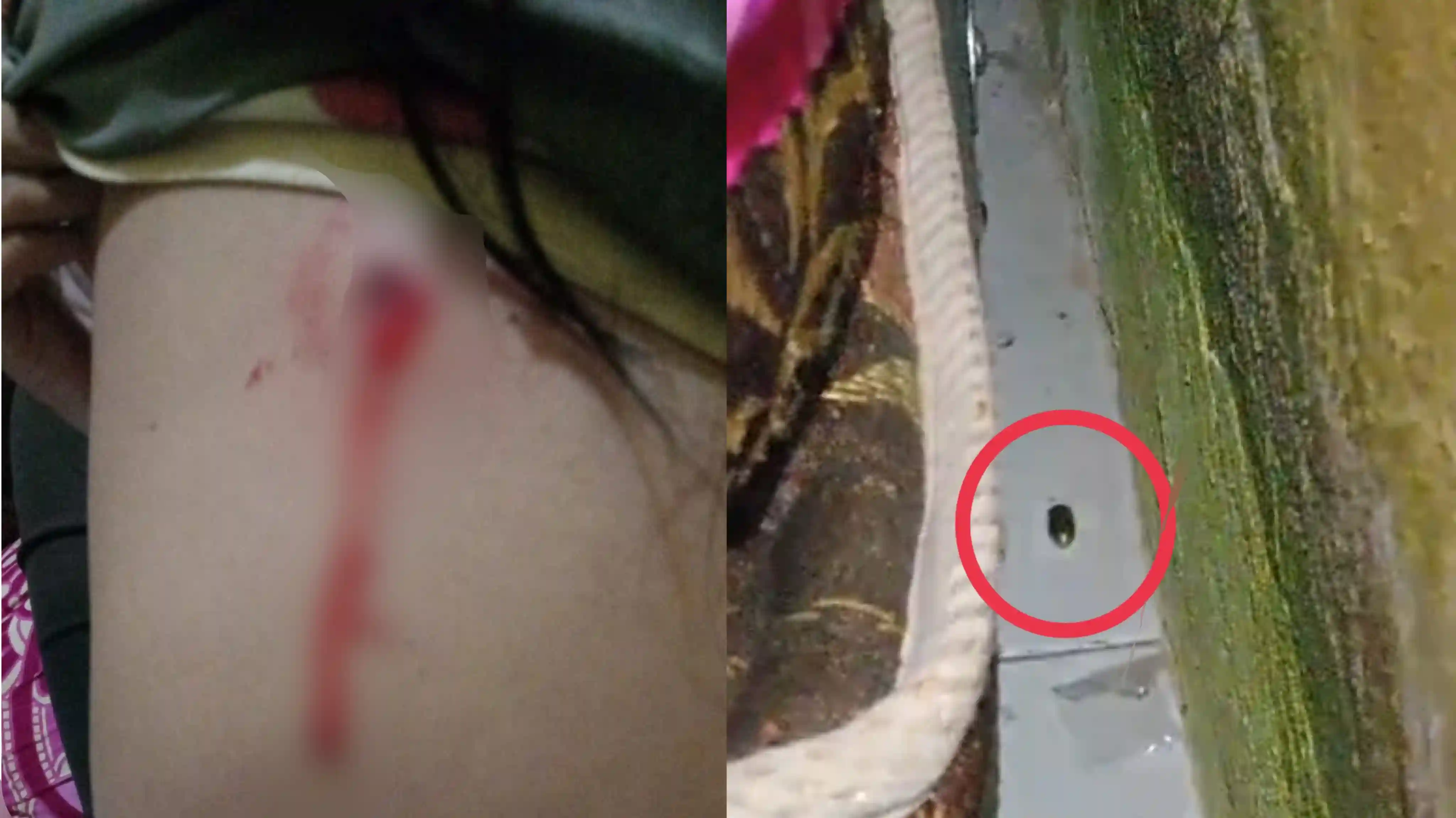 Bocah Perempuan Diduga Tertembak Peluru Nyasar di Kendari